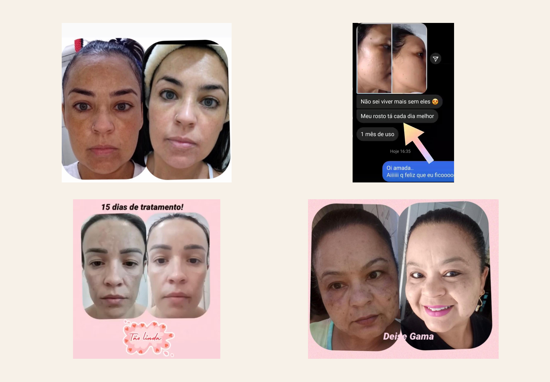 Antes x Depois real: resultado individual de cliente Deise Gama