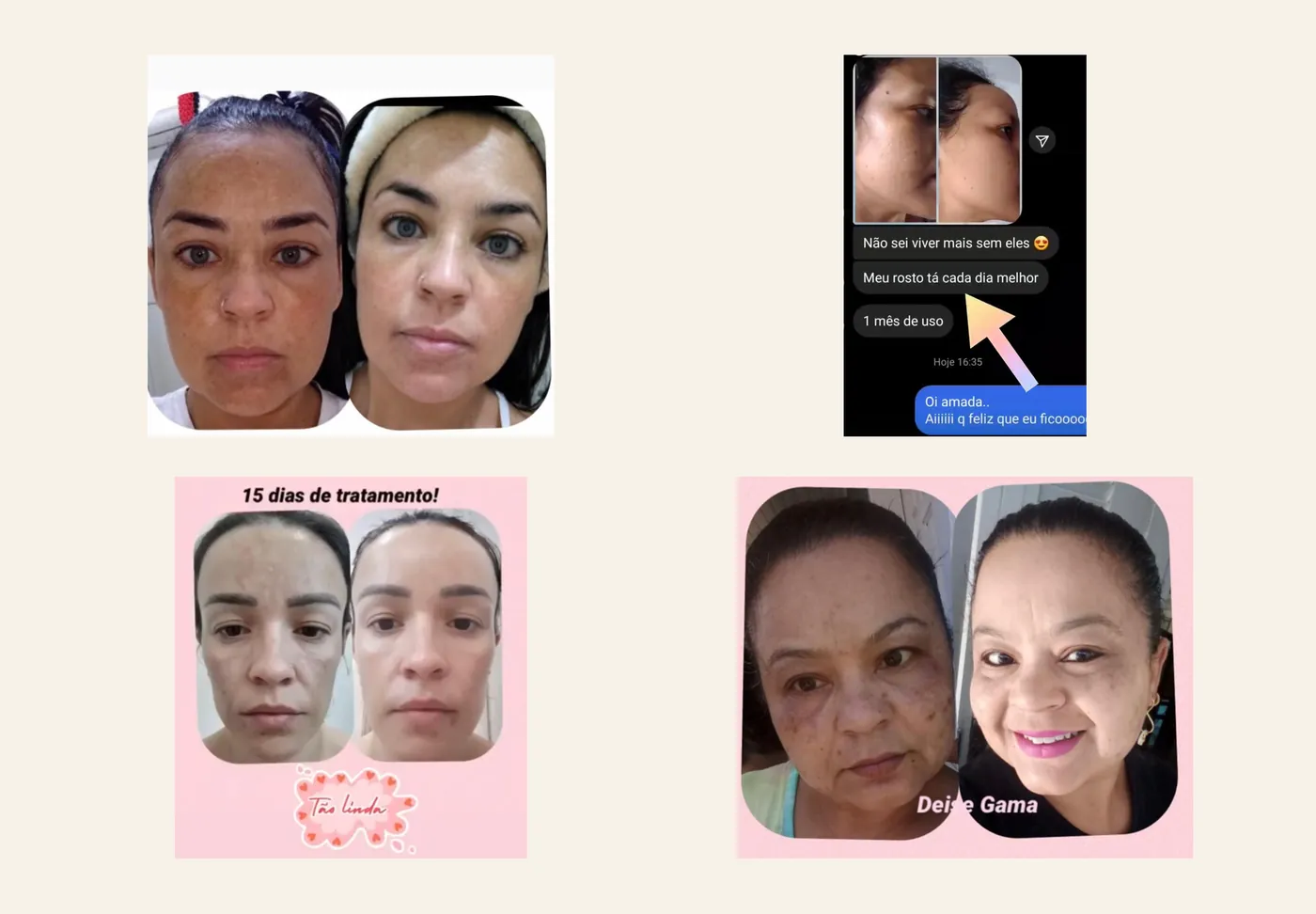 Antes x Depois real: resultado individual de cliente Deise Gama